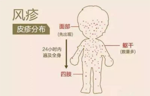 家长们注意！预防风疹小知识赶紧get起来！