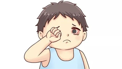 眼红并非嫉妒，可能是“红眼病”找上门！