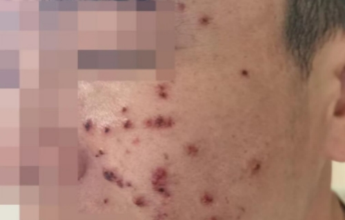 出院小牵挂丨三次细致治疗，让我从不敢抬头到重拾自信